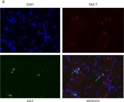 PAX7 antibodies - Antibody search engine - CiteAb