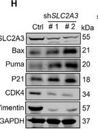 Fig.3.H showing Western Blotting from the publication: SLC2A3-Mediated Lactate Metabolism Promotes Lung Cancer Bone Metastasis by Modulating P53 Lactylation and Immune Evasion.