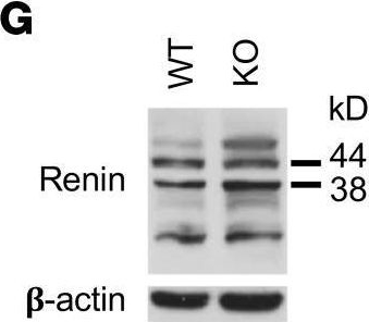 Fig.3.G showing Western Blotting from the publication: STOX1 deficiency is associated with renin-mediated gestational hypertension and placental defects.