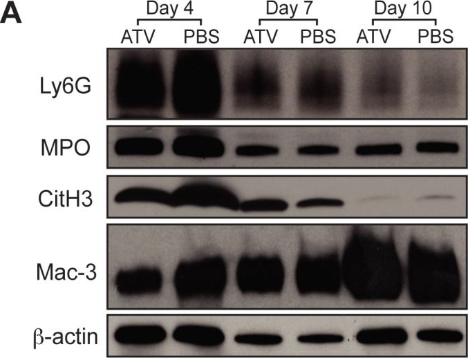 Fig.5.A showing Western Blotting from the publication: Statins improve the resolution of established murine venous thrombosis: reductions in thrombus burden and vein wall scarring.