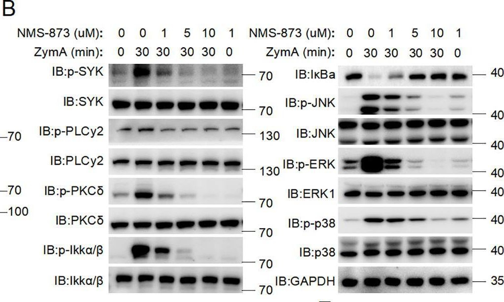 Fig.2.B showing Western Blotting from the publication: The protein segregase VCP/p97 promotes host antifungal defense via regulation of SYK activation.