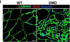 Fig.6.I showing Immunohistochemistry in a Rattus norvegicus (Rat) sample from the publication: Duchenne muscular dystrophy trajectory in R-DMDdel52 preclinical rat model identifies COMP as biomarker of fibrosis.