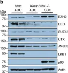 Fig.3.B showing Western Blotting in a Mus musculus (House mouse) sample from the publication: Lkb1 inactivation drives lung cancer lineage switching governed by Polycomb Repressive Complex 2.