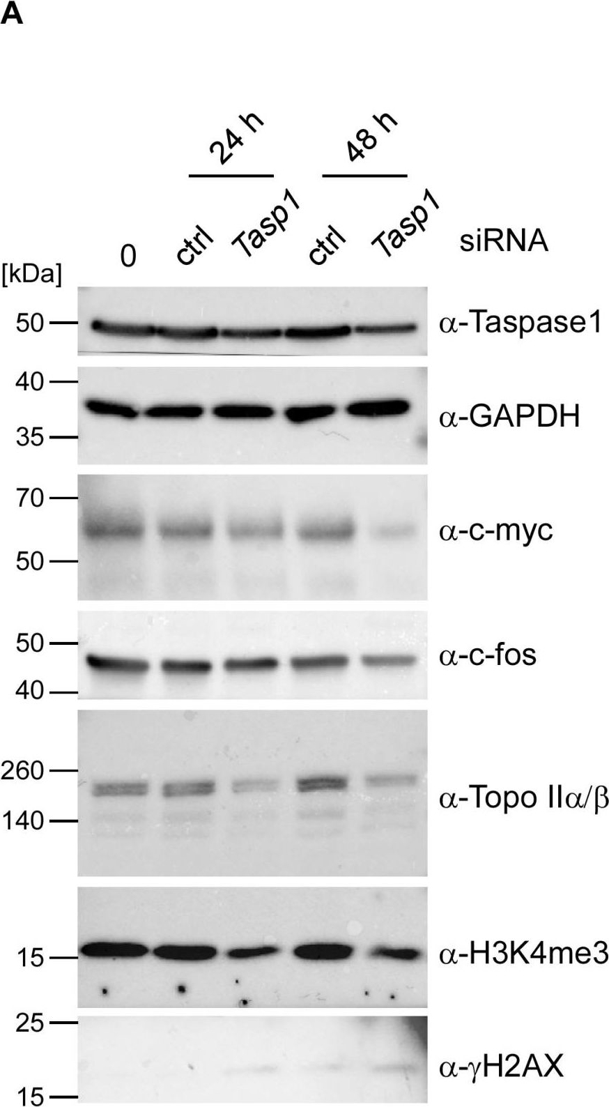 Fig.5.A showing Western Blotting in a Homo sapiens (Human) sample from the publication: Taspase1 Facilitates Topoisomerase IIβ-Mediated DNA Double-Strand Breaks Driving Estrogen-Induced Transcription.