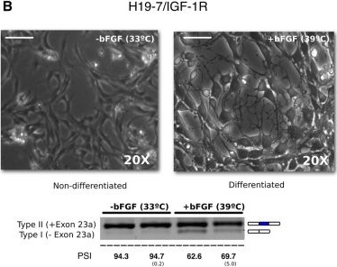 Fig.1.B from the publication: Using antisense oligonucleotides for the physiological modulation of the alternative splicing of NF1 exon 23a during PC12 neuronal differentiation.
