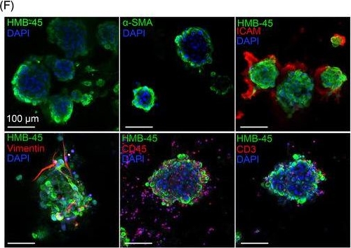 Fig.5.F showing Immunocytochemistry-immunofluorescence in a Homo sapiens (Human) sample from the publication: Preclinical platforms to study therapeutic efficacy of human γδ T cells.