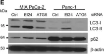 Fig.1.E showing Western Blotting in a Homo sapiens (Human) sample from the publication: EI24, as a Component of Autophagy, Is Involved in Pancreatic Cell Proliferation.