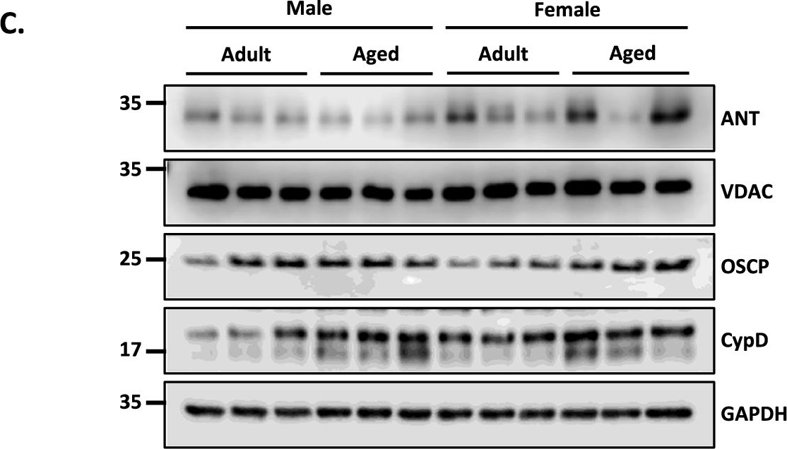 Fig.5.C showing Western Blotting from the publication: Unraveling sex differences in age-related hippocampal decline: differential mitochondrial dysfunction, Lonp1-dependent mitochondrial proteostasis and mtROS production in aged C57BL/6 mice.