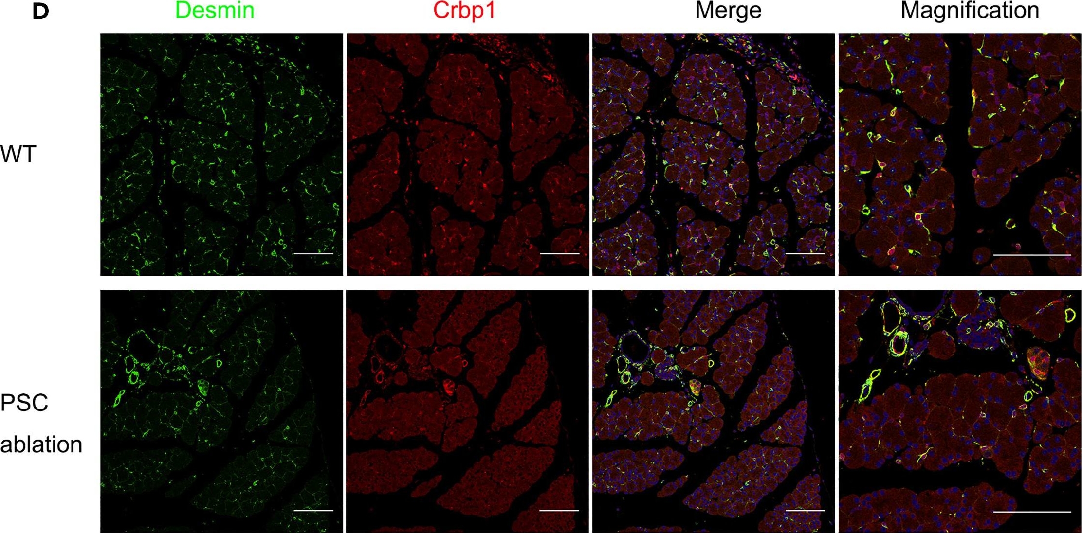 Fig.6.D showing Immunohistochemistry-immunofluorescence in a Mus musculus (House mouse) sample from the publication: Genetic lineage tracing reveals stellate cells as contributors to myofibroblasts in pancreas and islet fibrosis.