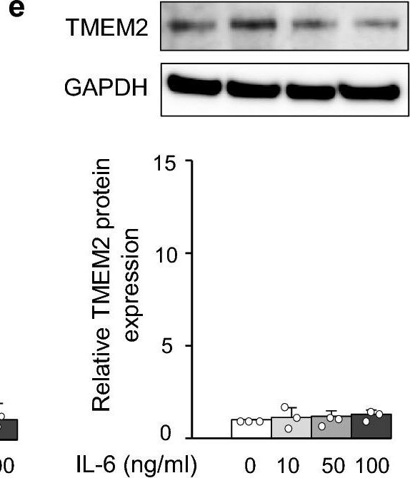 Fig.2.E showing Western Blotting from the publication: Expression and regulation of recently discovered hyaluronidases, HYBID and TMEM2, in chondrocytes from knee osteoarthritic cartilage.
