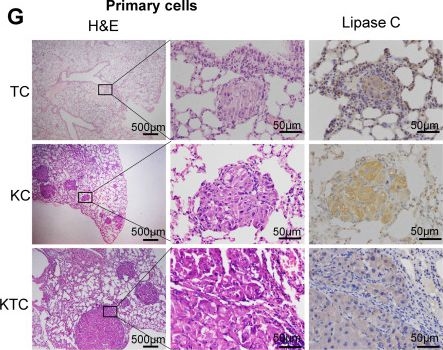 Fig.1.G showing Immunohistochemistry from the publication: Mutant Kras and mTOR crosstalk drives hepatocellular carcinoma development via PEG3/STAT3/BEX2 signaling.