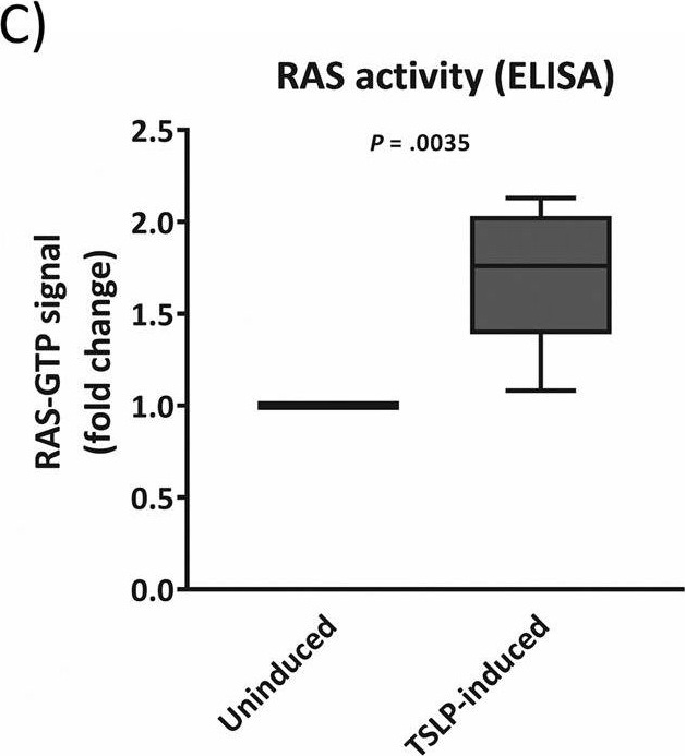 Fig.2.C showing Enzyme-linked immunosorbent assay in a Mus musculus (House mouse) sample from the publication: RAS-protein activation but not mutation status is an outcome predictor and unifying therapeutic target for high-risk acute lymphoblastic leukemia.