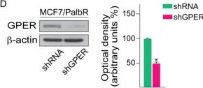 Fig.3.D showing Western Blotting in a Homo sapiens (Human) sample from the publication: The G Protein Estrogen Receptor (GPER) is involved in the resistance to the CDK4/6 inhibitor palbociclib in breast cancer.
