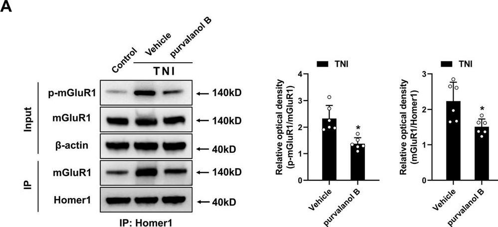 Fig.4.A from the publication: Preso enhances mGluR1-mediated excitotoxicity by modulating the phosphorylation of mGluR1-Homer1 complex and facilitating an ER stress after traumatic brain injury.