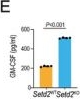 Fig.4.E showing Enzyme-linked immunosorbent assay from the publication: Tumor Cell-Intrinsic SETD2 Deficiency Reprograms Neutrophils to Foster Immune Escape in Pancreatic Tumorigenesis.
