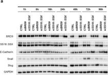 SS18-SSX (E9X9V) Rabbit Monoclonal Antibody | Cell Signaling