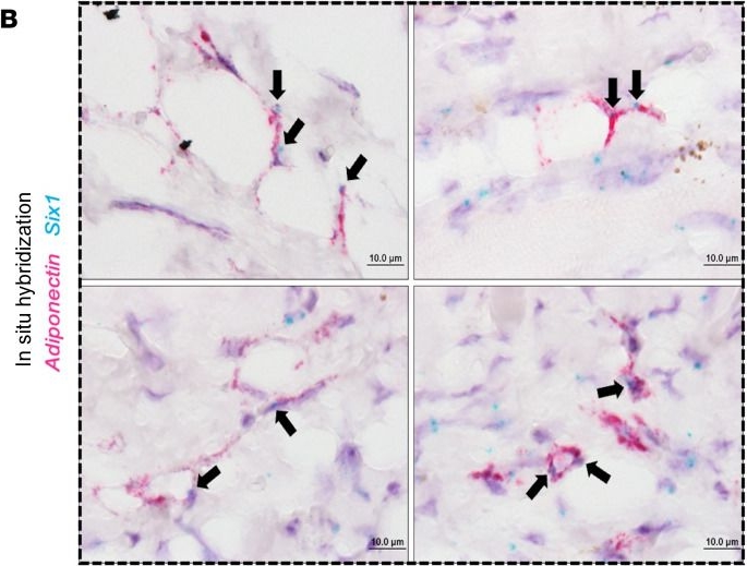 Fig.4.B showing Immunohistochemistry in a Mus musculus (House mouse) sample from the publication: Adipocyte-specific deletion of sine oculis homeobox homolog 1 inhibits lipolysis and reduces skin fibrosis.