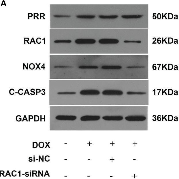 Fig.4.A showing Western Blotting in a Rattus norvegicus (Rat) sample from the publication: Inhibition of (Pro)renin Receptor-Mediated Oxidative Stress Alleviates Doxorubicin-Induced Heart Failure.