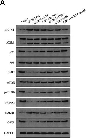 Fig.3.A showing Western Blotting in a Rattus norvegicus (Rat) sample from the publication: The effect of QiangGuYin on osteoporosis through the AKT/mTOR/autophagy signaling pathway mediated by CKIP-1.