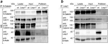 Fig.5.A,B showing Western Blotting in a Mus musculus (House mouse) sample from the publication: Lasp1 regulates adherens junction dynamics and fibroblast transformation in destructive arthritis.