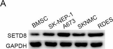 Fig.2.A showing Western Blotting in a Homo sapiens (Human) sample from the publication: SETD8 inhibits apoptosis and ferroptosis of Ewing's sarcoma through YBX1/RAC3 axis.