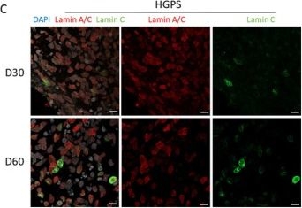 Fig.2.C showing Immunohistochemistry-immunofluorescence in a Homo sapiens (Human) sample from the publication: Patient-Derived Cortical Organoids Reveal Senescence of Neural Progenitor Cells in Hutchinson-Gilford Progeria Syndrome.