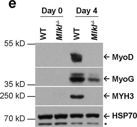 Fig.1.E showing Western Blotting from the publication: Myofiber necroptosis promotes muscle stem cell proliferation via releasing Tenascin-C during regeneration.