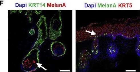 Fig.2.F showing Immunohistochemistry-immunofluorescence in a Homo sapiens (Human) sample from the publication: Wnt-activating human skin organoid model of atopic dermatitis induced by Staphylococcus aureus and its protective effects by Cutibacterium acnes.