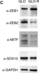 Fig.2.C showing Western Blotting from the publication: An in vivo avian model of human melanoma to perform rapid and robust preclinical studies.