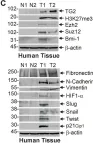 Fig.2.C showing Western Blotting in a Mus musculus (House mouse) sample from the publication: Transglutaminase is a mesothelioma cancer stem cell survival protein that is required for tumor formation.