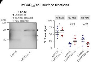 Fig.1.F showing Western Blotting from the publication: Transmembrane Serine Protease 2 and Proteolytic Activation of the Epithelial Sodium Channel in Mouse Kidney.
