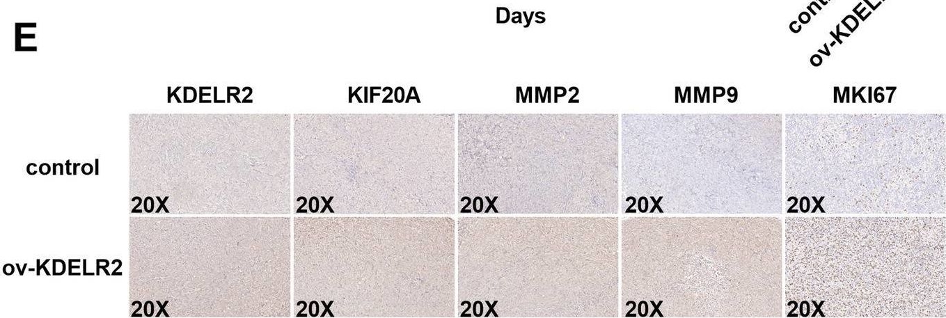 Fig.6.E showing Immunohistochemistry from the publication: KDELR2-KIF20A axis facilitates bladder cancer growth and metastasis by enhancing Golgi-mediated secretion.