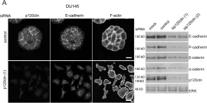 Fig.1.A showing Western Blotting in a Homo sapiens (Human) sample from the publication: p120ctn and P-cadherin but not E-cadherin regulate cell motility and invasion of DU145 prostate cancer cells.