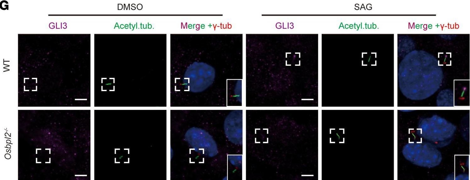 Fig.5.G showing Immunocytochemistry-immunofluorescence in a Mus musculus (House mouse) sample from the publication: Mutations in OSBPL2 cause hearing loss associated with primary cilia defects via sonic hedgehog signaling.