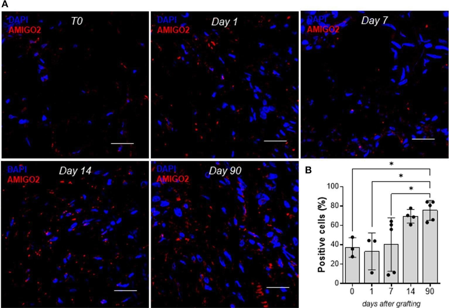 Fig.9.A showing Immunohistochemistry-immunofluorescence in a Homo sapiens (Human) sample from the publication: Mechanical Strain Induces Transcriptomic Reprogramming of Saphenous Vein Progenitors.