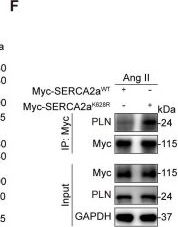 Fig.6.F showing Western Blotting in a Mus musculus (House mouse) sample from the publication: Cardiomyocyte-derived OTUD7B promotes cardiac hypertrophy by deubiquitinating SERCA2a.