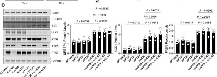 Fig.3.C showing Western Blotting from the publication: The ULK1-NCOA3 axis restrains de novo lipogenesis and prevents diet-induced steatohepatitis and fibrosis in mice.