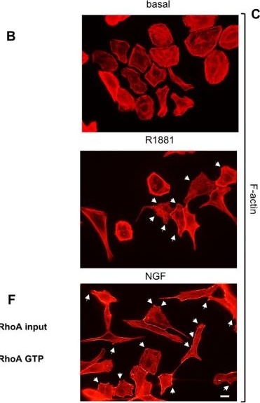 Fig.1.B showing Immunocytochemistry-immunofluorescence from the publication: Androgens and NGF Mediate the Neurite-Outgrowth through Inactivation of RhoA.