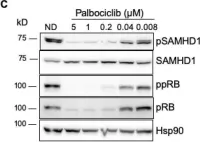 Fig.3.C showing Western Blotting from the publication: Pharmacological Modulation of SAMHD1 Activity by CDK4/6 Inhibitors Improves Anticancer Therapy.