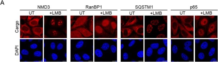 Fig.5.A showing Immunocytochemistry-immunofluorescence in a Homo sapiens (Human) sample from the publication: Mutations of Key Functional Residues in CRM1/XPO1 Differently Alter Its Intranuclear Localization and the Nuclear Export of Endogenous Cargos.