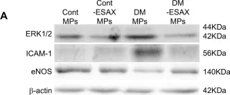 Fig.4.A showing Western Blotting in a Mus musculus (House mouse) sample from the publication: Effect of esaxerenone on the onset of aortic endothelial dysfunction and circulating microparticles in type 1 diabetic male mice.