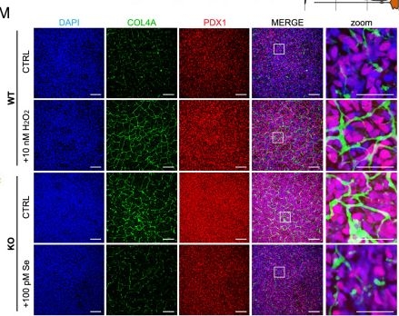 Fig.3.V showing Immunocytochemistry-immunofluorescence in a Homo sapiens (Human) sample from the publication: Oxidative stress and GPX2 control pancreatic vs. non-pancreatic cell fate in human endoderm.