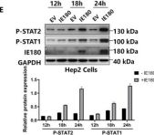 Phospho-Stat1 (Tyr701) (58D6) Rabbit mAb | Cell Signaling