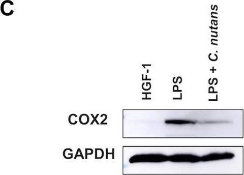 Fig.3.C showing Western Blotting from the publication: Clinacanthus nutans extract lowers periodontal inflammation under high-glucose conditions via inhibiting NF-κB signaling pathway.