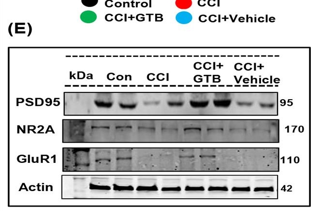 Fig.4.E showing Western Blotting in a Mus musculus (House mouse) sample from the publication: Corrected Version: Protection of Mice from Controlled Cortical Impact Injury by Food Additive Glyceryl Tribenzoate.