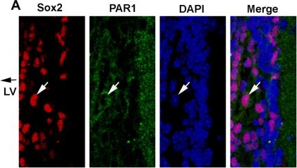 Fig.1.A showing Immunohistochemistry-immunofluorescence in a Mus musculus (House mouse) sample from the publication: The Thrombin Receptor Restricts Subventricular Zone Neural Stem Cell Expansion and Differentiation.