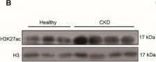 Fig.6.B showing Western Blotting from the publication: ACLY-Driven Metabolic Reprogramming Promotes Histone Acetylation and Inflammation-Associated Fibrosis in Chronic Kidney Disease.