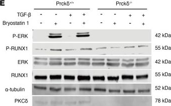 Fig.3.E showing Western Blotting from the publication: Regulation of selective class switching provides long-term therapeutic benefits for hay fever.