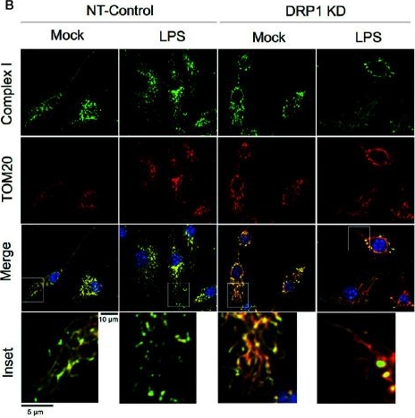 Fig.1.B showing Immunocytochemistry-immunofluorescence in a Salmonella sample from the publication: The Mitochondrial Fission Regulator DRP1 Controls Post-Transcriptional Regulation of TNF-α.