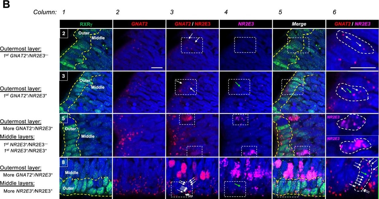 Fig.7.B showing Immunohistochemistry-immunofluorescence from the publication: Identification and characterization of early human photoreceptor states and cell-state-specific retinoblastoma-related features.